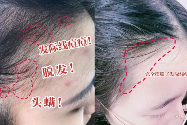 冬洗头干发神器！养出女明星绸缎发！开元棋牌app国产变态“抽水帽”入(图4)